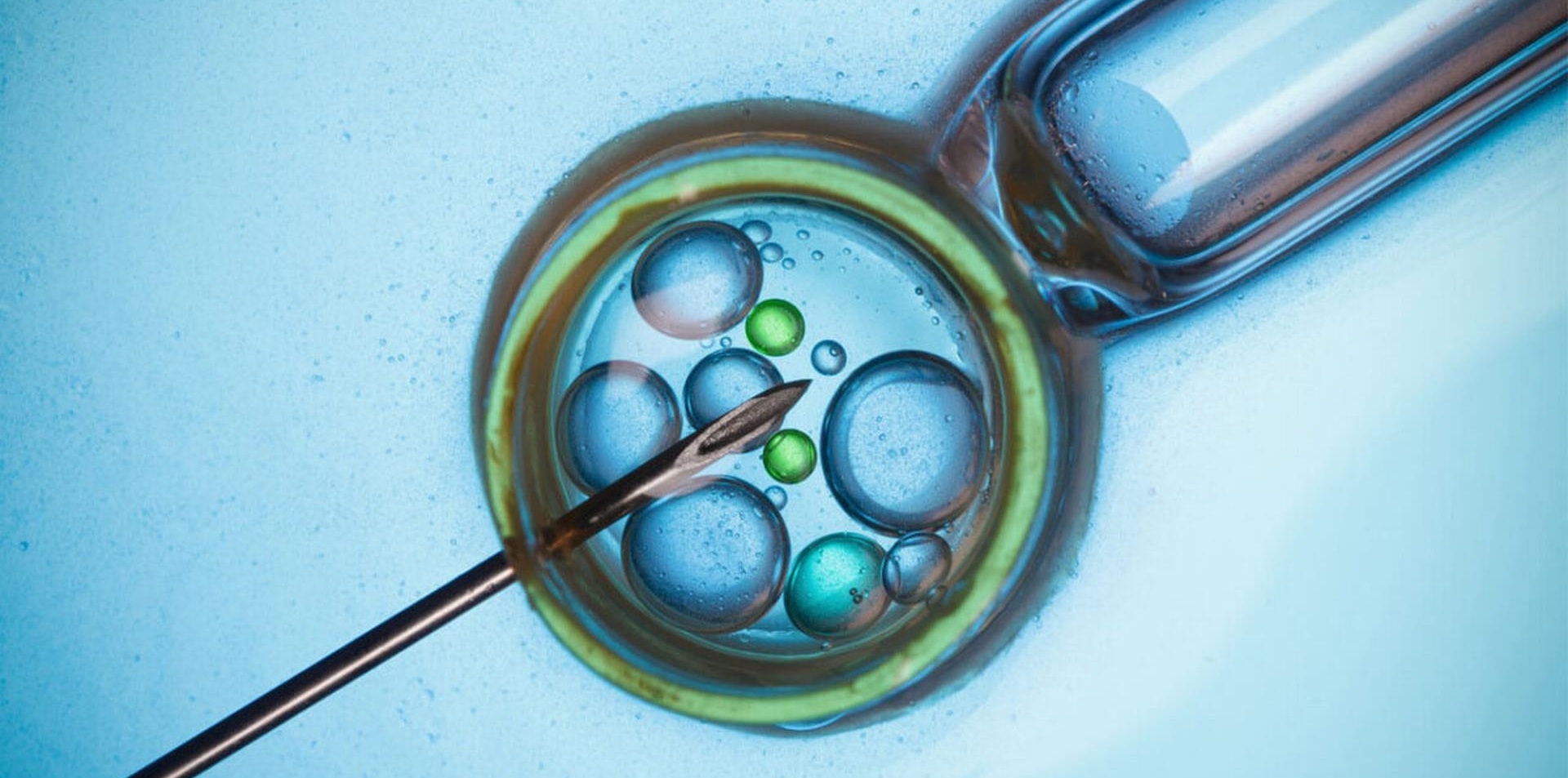 Productos IVF Grupo